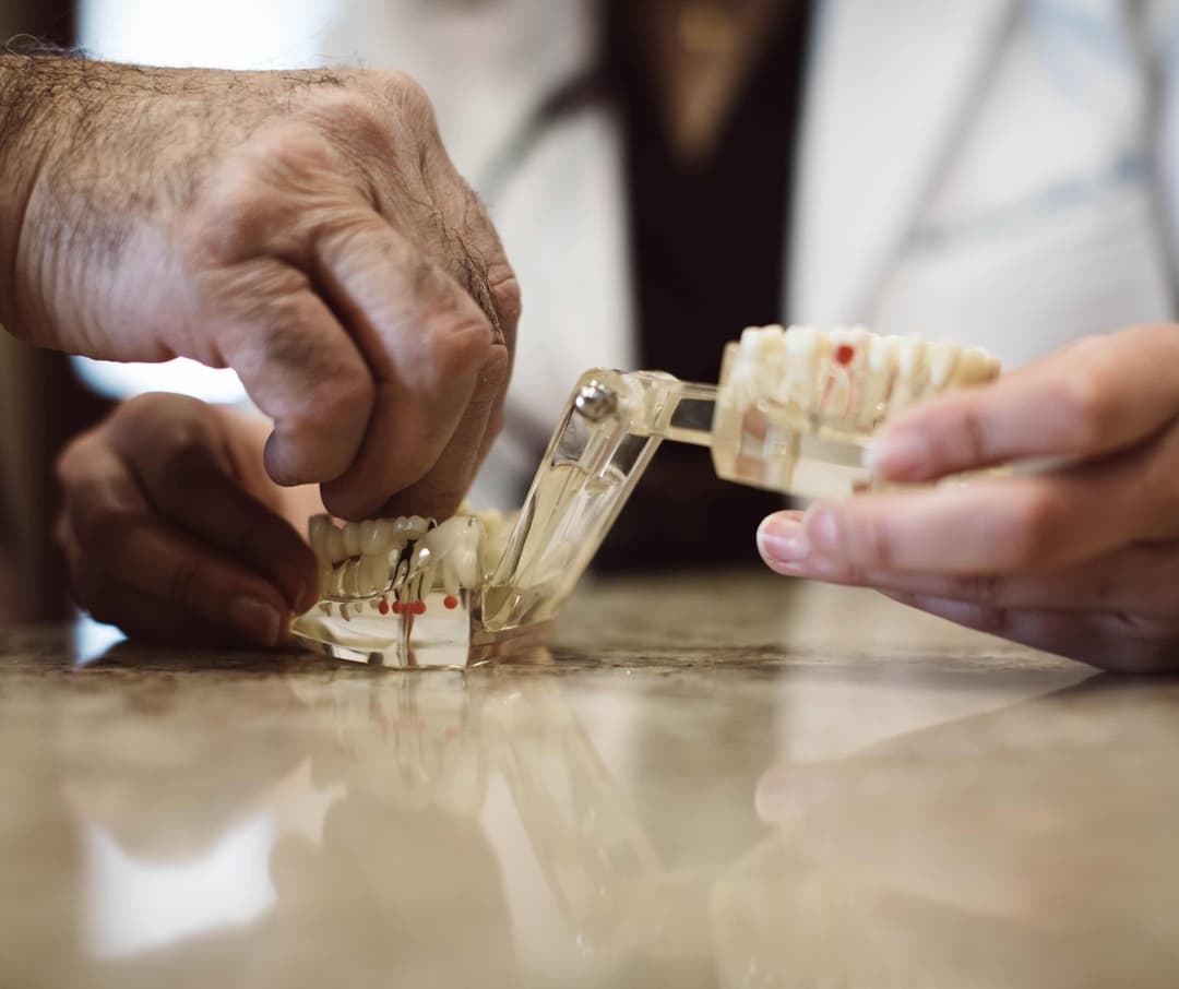 Dental Implants